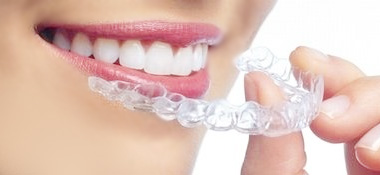 精巧に作られたマウスピース矯正